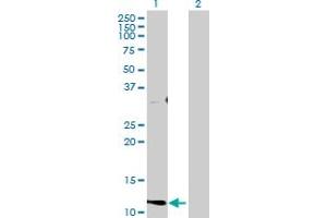 Western Blot analysis of CST1 expression in transfected 293T cell line by CST1 MaxPab polyclonal antibody. (CST1 antibody  (AA 1-141))