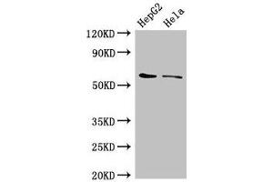 Western Blot Positive WB detected in: HepG2 whole cell lysate, Hela whole cell lysate All lanes: CDT1 antibody at 3 μg/mL Secondary Goat polyclonal to rabbit IgG at 1/50000 dilution Predicted band size: 61 kDa Observed band size: 61 kDa
