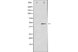 Western blot analysis of GATA4 expression in Serum treated COLO205 whole cell lysates,The lane on the left is treated with the antigen-specific peptide. (GATA4 antibody  (Internal Region))
