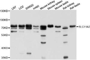 Western blot analysis of extracts of various cell lines, using SLC11A2 antibody (ABIN4905173) at 1:1000 dilution. (SLC11A2 antibody)