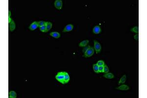 Immunofluorescent analysis of HepG2 cells using ABIN7156651 at dilution of 1:100 and Alexa Fluor 488-congugated AffiniPure Goat Anti-Rabbit IgG(H+L) (IFIH1 antibody  (AA 700-1025))