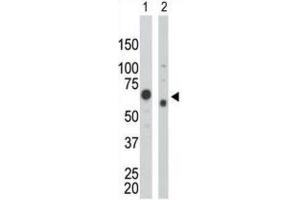 Western Blotting (WB) image for anti-Pyruvate Kinase (PK) antibody (ABIN2995247) (Pyruvate Kinase antibody)
