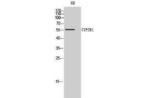 Western Blotting (WB) image for anti-Cytochrome P450, Family 2, Subfamily E, Polypeptide 1 (CYP2E1) (C-Term) antibody (ABIN3184187) (CYP2E1 antibody  (C-Term))