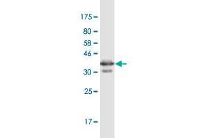 Western Blot detection against Immunogen (36. (PGRMC1 antibody  (AA 96-195))