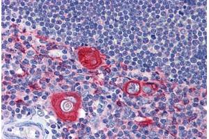 Human Thymus: Formalin-Fixed, Paraffin-Embedded (FFPE) (SNAPIN antibody  (AA 41-137))