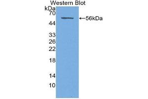 Western Blotting (WB) image for anti-Syndecan 1 (SDC1) (AA 23-253) antibody (ABIN1870669) (Syndecan 1 antibody  (AA 23-253))