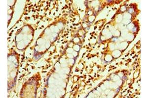 Immunohistochemistry of paraffin-embedded human small intestine tissue using ABIN7167347 at dilution of 1:100 (Rab4 antibody  (AA 1-218))