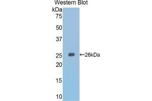 Western blot analysis of the recombinant protein. (SLIT3 antibody  (AA 1348-1517))