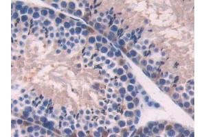 Detection of ADK in Mouse Testis Tissue using Polyclonal Antibody to Adenosine Kinase (ADK) (ADK antibody  (AA 1-361))