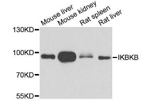 Western blot analysis of extracts of various cell lines, using IKBKB antibody. (IKBKB antibody  (AA 517-756))
