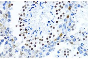 Immunohistochemistry of paraffin-embedded Mouse testis using TriMethyl-Histone H3-K79 Polyclonal Antibody at dilution of 1:200 (40x lens).