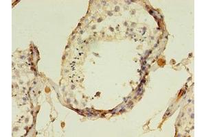 Immunohistochemistry of paraffin-embedded human testis tissue using ABIN7157768 at dilution of 1:100 (AADAT antibody  (AA 30-425))