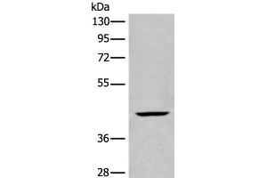 Western blot analysis of Human kidney tissue lysate using BBOX1 Polyclonal Antibody at dilution of 1:650