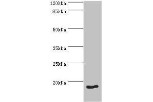 Western blot analysis of HeLa whole cell lysate, using NT-proBNP antibody (2 μg/ml). (NT-ProBNP antibody  (AA 27-102))