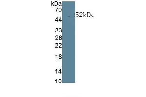 Detection of Recombinant LBP, Human using Monoclonal Antibody to Lipopolysaccharide Binding Protein (LBP) (LBP antibody  (AA 27-481))