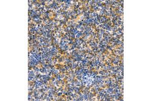 Immunohistochemistry of paraffin embedded rat lymph node using CD30 (ABIN7076073) at dilution of 1:600 (400x lens) (TNFRSF8 antibody)