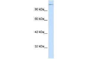 WB Suggested Anti-SUPT5H Antibody Titration: 0. (SUPT5H antibody  (C-Term))