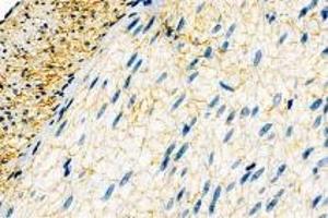 Immunohistochemistry (Paraffin-embedded Sections) (IHC (p)) image for anti-Dystrophia Myotonica-Protein Kinase (DMPK) antibody (ABIN7073790)