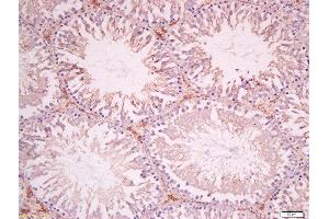 Formalin-fixed and paraffin embedded rat testis tissue labeled with Anti-SOAT1 Polyclonal Antibody, Unconjugated 1:400 followed by conjugation to the secondary antibody and DAB staining. (SOAT1 antibody  (AA 51-150))