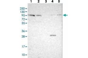 Western blot analysis of Lane 1: RT-4, Lane 2: U-251 MG, Lane 3: Human Plasma, Lane 4: Liver, Lane 5: Tonsil with CDH26 polyclonal antibody .