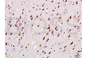 Formalin-fixed and paraffin embedded: rat brain tissue labeled with Anti-MAG-a/L-MAG Polyclonal Antibody (ABIN726935), Unconjugated at 1:200, followed by conjugation to the secondary antibody and DAB staining
