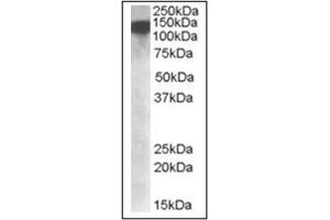 Image no. 1 for anti-ATP-Dependent RNA Helicase A (DHX9) (Internal Region) antibody (ABIN375159) (DHX9 antibody  (Internal Region))