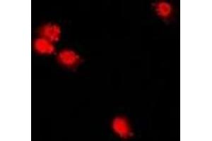 Immunofluorescent analysis of CHRAC17 staining in U2OS cells. (POLE3 antibody)