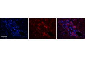 Rabbit Anti-C11orf24 Antibody      Formalin Fixed Paraffin Embedded Tissue: Human Adult Liver   Observed Staining: Membrane but only in connective tissue cells in the interlobular septum, very low tissue distribution  Primary Antibody Concentration: 1:100  Secondary Antibody: Donkey anti-Rabbit-Cy3  Secondary Antibody Concentration: 1:200  Magnification: 20X  Exposure Time: 0. (C11orf24 antibody  (N-Term))