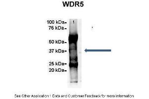 Amount and Sample Type :  500 ug Human NT2 cell lysate  Amount of IP Antibody :  6 ug  Primary Antibody :  WDR5  Primary Antibody Dilution :  1:500  Secondary Antibody :  Goat anti-rabbit Alexa-Fluor 594  Secondary Antibody Dilution :  1:5000  Gene Name :  WDR5  Submitted by :  Dr. (WDR5 antibody  (C-Term))
