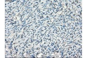 Image no. 3 for anti-Fc gamma RII (CD32) antibody (ABIN1497256) (Fc gamma RII (CD32) antibody)