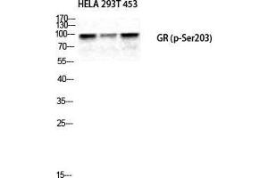 Western Blot (WB) analysis of HeLa 293T 453 cells using Phospho-GR (S203) Polyclonal Antibody. (GR (pSer203) antibody)