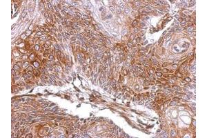 IHC-P Image Immunohistochemical analysis of paraffin-embedded Cal27 xenograft, using ELA3A, antibody at 1:500 dilution. (Elastase 3A antibody)