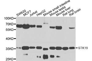 Western blot analysis of extracts of various cell lines, using STK19 antibody. (STK19 antibody)