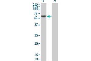 Western Blot analysis of IRF6 expression in transfected 293T cell line by IRF6 MaxPab polyclonal antibody. (IRF6 antibody  (AA 1-467))