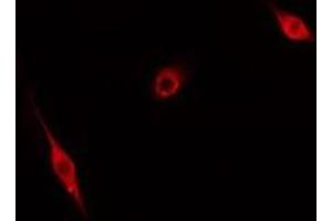 ABIN6276631 staining Hela cells by IF/ICC. (CDC20 antibody  (N-Term))