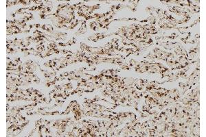 ABIN6268880 at 1/100 staining Human lung tissue by IHC-P. (FASL antibody  (Internal Region))