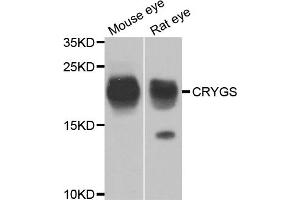 Western blot analysis of extracts of various cell lines, using CRYGS antibody. (CRYGS antibody)
