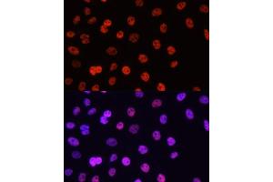 Immunofluorescence analysis of HeLa cells using Asymmetric DiMethyl-Histone H3-R17 antibody (ABIN3023282, ABIN3023283, ABIN3023284 and ABIN6219538) at dilution of 1:100. (Histone 3 antibody  (H3R17me))