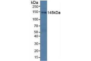 Western blot analysis of Human HeLa cells. (PALLD antibody  (AA 1137-1383))