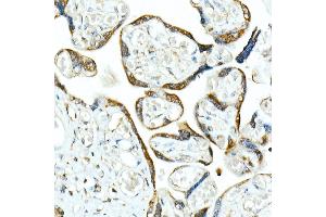 Immunohistochemistry of paraffin-embedded human placenta using Smad9 Rabbit pAb (ABIN6132668, ABIN6148096, ABIN6148097 and ABIN6223425) at dilution of 1:100 (40x lens). (SMAD9 antibody  (AA 1-300))