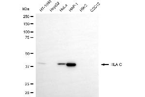 Western blotting analysis using HLA-C antibody (ABIN7799321). (HLA-C antibody)
