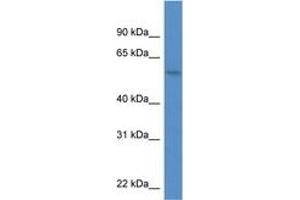 Image no. 1 for anti-MON1 Homolog A (MON1A) (AA 376-425) antibody (ABIN6746833) (MON1A antibody  (AA 376-425))