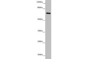 Western blot All lanes: ZNF169 antibody at 5. (ZNF169 antibody  (AA 1-85))