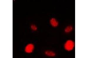 Immunofluorescent analysis of RAD54A staining in HEK293T cells. (RAD54L antibody)