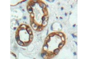 Used in DAB staining on fromalin fixed paraffin-embedded Kidney tissue (ALT antibody  (AA 290-533))