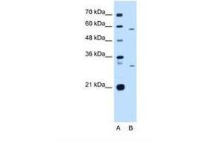 Image no. 2 for anti-CD36 (CD36) (N-Term) antibody (ABIN6738418) (CD36 antibody  (N-Term))