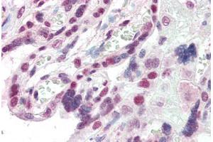 Human Placenta (formalin-fixed, paraffin-embedded) stained with CBX1 antibody ABIN337122 at 2. (CBX1 antibody  (AA 69-81))