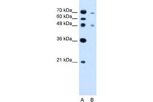 WB Suggested Anti-ZFYVE27 Antibody Titration:  2. (ZFYVE27 antibody  (C-Term))