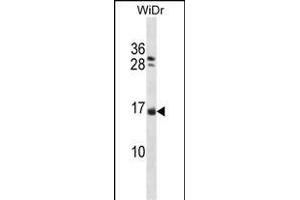 NHLH1 Antibody (Center) (ABIN1538365 and ABIN2848569) western blot analysis in WiDr cell line lysates (35 μg/lane). (NHLH1 antibody  (AA 38-67))