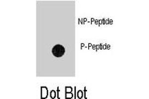 Dot blot analysis of ANTXR1 (phospho Y382) polyclonal antibody  on nitrocellulose membrane. (ANTXR1 antibody  (pTyr382))